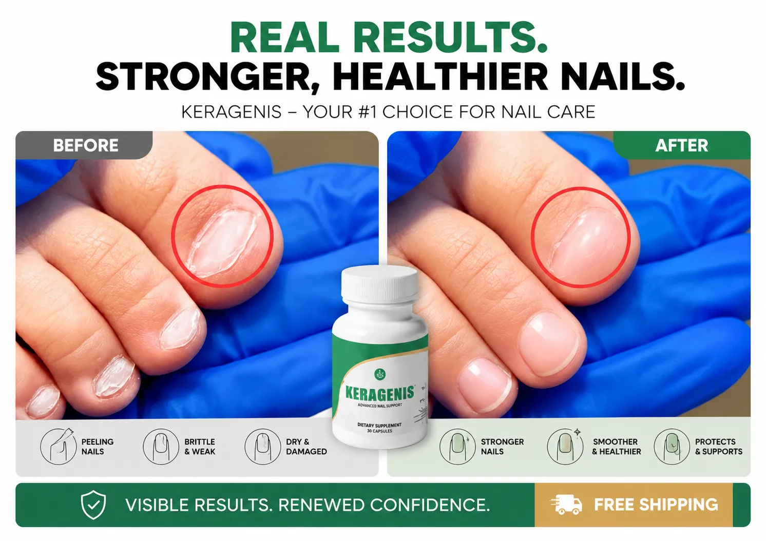 KeraGenis supplement support for nails before and after illustration